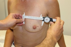 Choosing the Right Size of Breast Implants