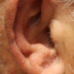 Reconstructed ear
